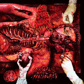 Manual Manic Procedures : Coloured Vinyl